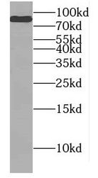 DNAI1 Rabbit Polyclonal Antibody