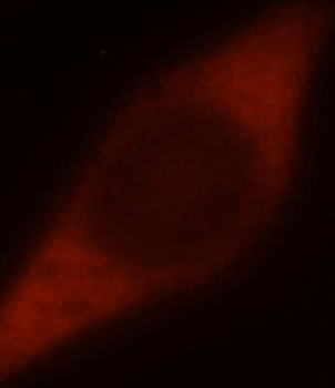 DNAJB4 Rabbit Polyclonal Antibody