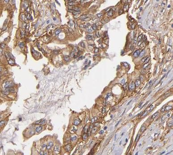 DNAJB4 Rabbit Polyclonal Antibody