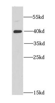 DNAJB6 Rabbit Polyclonal Antibody