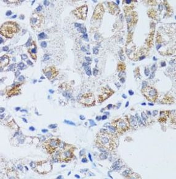 DNAJC19 Antibody