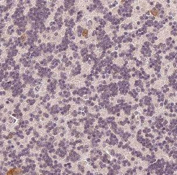 DNAJC6 Rabbit Polyclonal Antibody