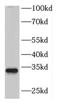 DNASE1L1 Rabbit Polyclonal Antibody