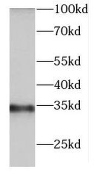 DNASE1L3 Rabbit Polyclonal Antibody