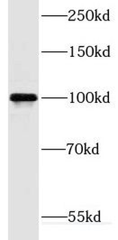 DNM2 Rabbit Polyclonal Antibody