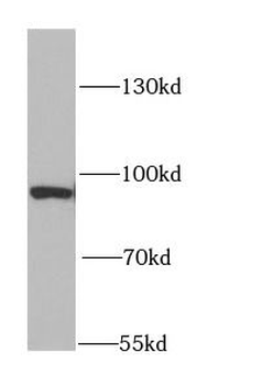 DNMT3A Rabbit Polyclonal Antibody