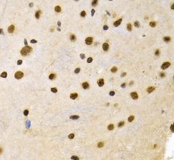 DNMT3A Rabbit Polyclonal Antibody