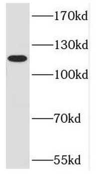 DNMT3A Rabbit Polyclonal Antibody