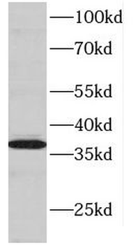 DNTTIP1 Antibody
