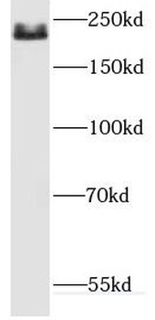 DOCK8 Rabbit Polyclonal Antibody