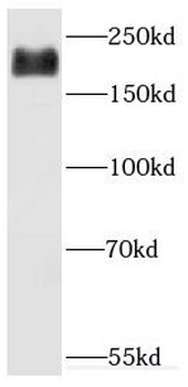 DOCK9 Rabbit Polyclonal Antibody