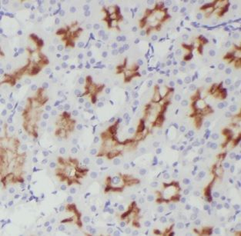 DOCK9 Rabbit Polyclonal Antibody