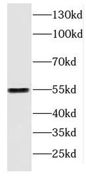 DOK2 Rabbit Polyclonal Antibody