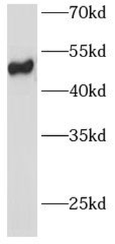 DPEP2 Rabbit Polyclonal Antibody
