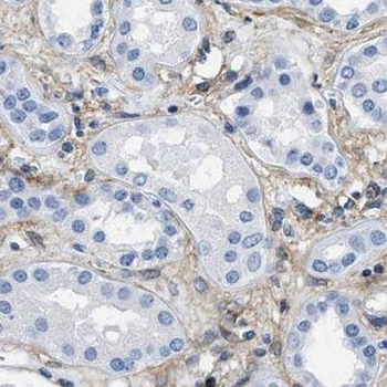 DPEP2 Rabbit Polyclonal Antibody