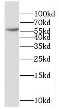 DPP9 Rabbit Polyclonal Antibody