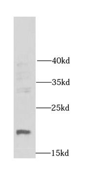 DR1 Rabbit Polyclonal Antibody