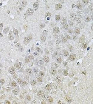 DR1 Rabbit Polyclonal Antibody