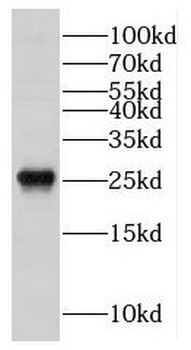 DRAP1 Rabbit Polyclonal Antibody