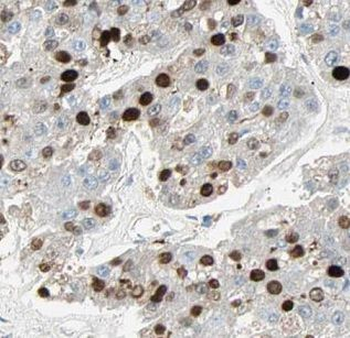 DRAP1 Rabbit Polyclonal Antibody