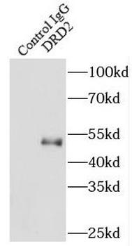 DRD2 Rabbit Polyclonal Antibody