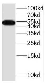 DRD5 Rabbit Polyclonal Antibody