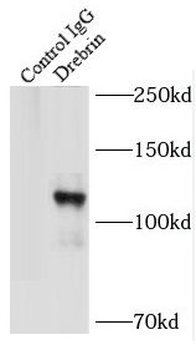 DBN1 Antibody
