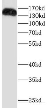 DROSHA Rabbit Polyclonal Antibody