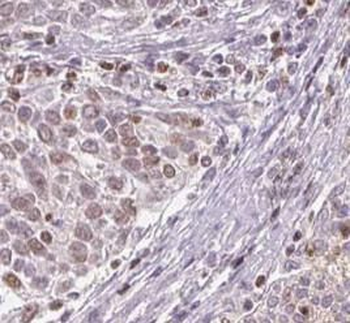 SEM1 Rabbit Polyclonal Antibody