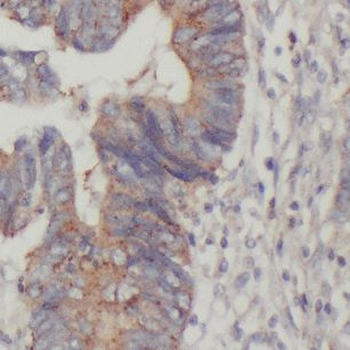 DTX1 Rabbit Polyclonal Antibody