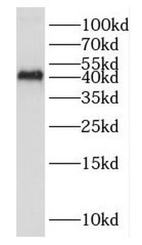 DUSP9 Rabbit Polyclonal Antibody