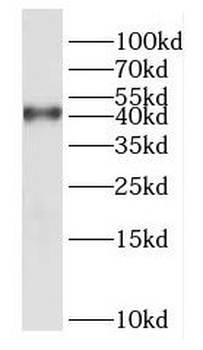 DUSP9 Rabbit Polyclonal Antibody