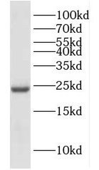 DUT Rabbit Polyclonal Antibody