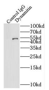 DCTN2 Rabbit Polyclonal Antibody