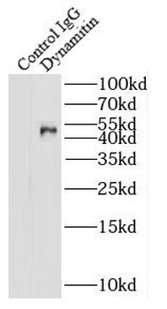 DCTN2 Rabbit Polyclonal Antibody