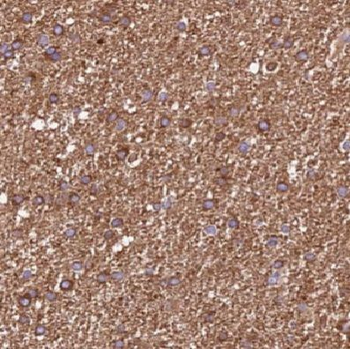 DCTN2 Rabbit Polyclonal Antibody