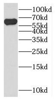 DYNC1LI2 Rabbit Polyclonal Antibody
