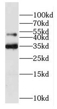 DTNBP1 Antibody
