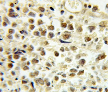 E2F4 Rabbit Polyclonal Antibody