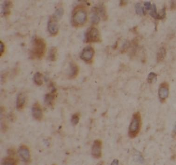 SLC1A2 Rabbit Polyclonal Antibody