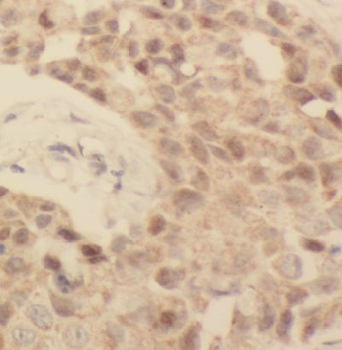 EAF2 Rabbit Polyclonal Antibody