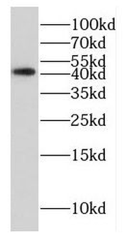EAPP Rabbit Polyclonal Antibody