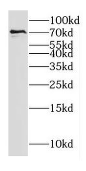 ECD Rabbit Polyclonal Antibody