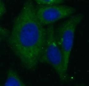 ECM1 Rabbit Polyclonal Antibody