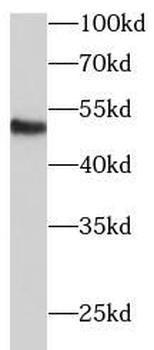 ECM1 Rabbit Polyclonal Antibody