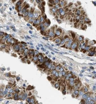 ECM1 Rabbit Polyclonal Antibody