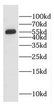 EDC3 Rabbit Polyclonal Antibody