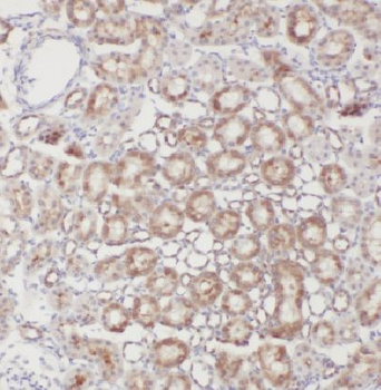 EDC3 Rabbit Polyclonal Antibody
