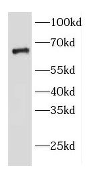EDEM2 Rabbit Polyclonal Antibody