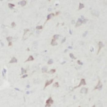 ANP32B Antibody